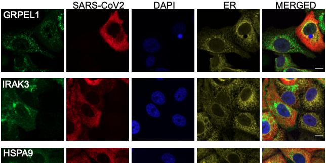  Large scale immunofluorescence to explore the host cell response to SARS-CoV-2 infection